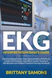 Ekg Interpretation Basics Guide
