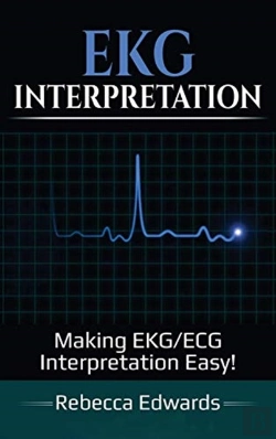Bertrand.pt - Ekg Interpretation: Making Ekg-Ecg Inter