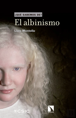 Bertrand.pt - El Albinismo