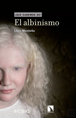 Bertrand.pt - El Albinismo