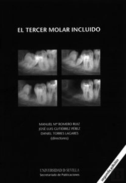 Bertrand.pt - El Tercer Molar Incluido