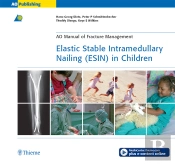 Elastic Stable Intramedullary Nailing (Esin) In Children