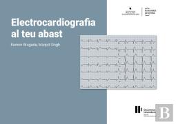Electrocardiografia Al Teu Abast