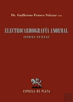 Bertrand.pt - Electrocardiografía Anormal