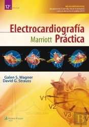 Electrocardiografia Practica