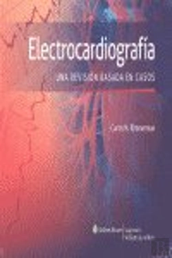 Bertrand.pt - Electrocardiografí¡A. Una Revisión Basada En Casos