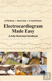 Electrocardiogram Made Easy