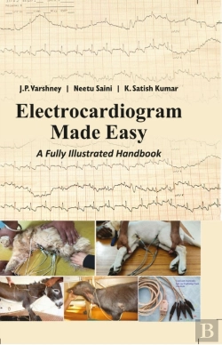 Bertrand.pt - Electrocardiogram Made Easy