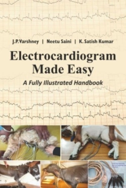 Bertrand.pt - Electrocardiogram Made Easy