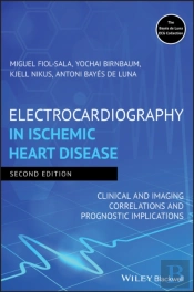 Electrocardiography In Ischemic Heart Disease