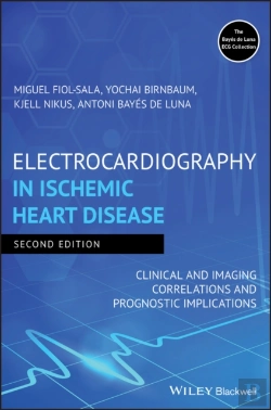 Bertrand.pt - Electrocardiography In Ischemic Heart Disease