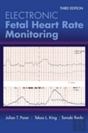 Electronic Fetal Heart Rate Monitoring: The 5-Tier System