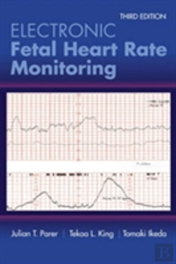 Bertrand.pt - Electronic Fetal Heart Rate Monitoring: The 5-Tier System