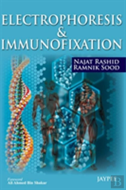 Bertrand.pt - Electrophoresis & Immunofixation