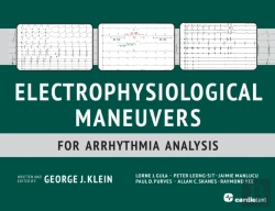 Bertrand.pt - Electrophysiological Maneuvers For Arrhythmia Analysis