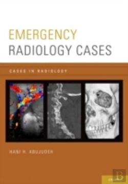 Bertrand.pt - Emergency Radiology Cases