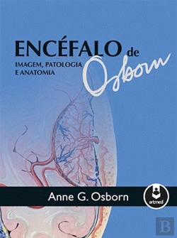 Bertrand.pt - Encéfalo de Osborn