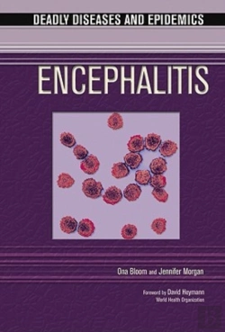 Bertrand.pt - Encephalitis