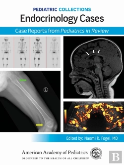 Bertrand.pt - Endocrinology Cases