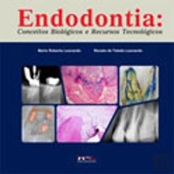 Bertrand.pt - Endodontia