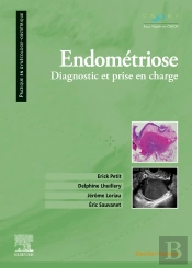Endométriose ; Diagnostic Et Prise En Charge