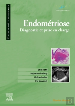 Bertrand.pt - Endométriose ; Diagnostic Et Prise En Charge