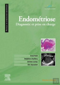 Bertrand.pt - Endométriose