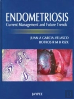 Bertrand.pt - Endometriosis