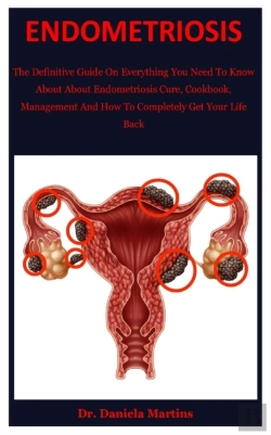 Bertrand.pt - Endometriosis