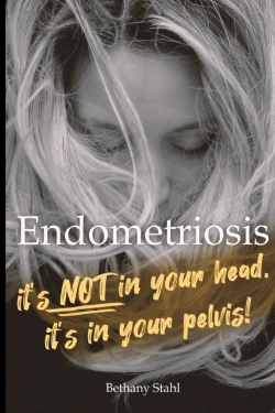 Bertrand.pt - Endometriosis