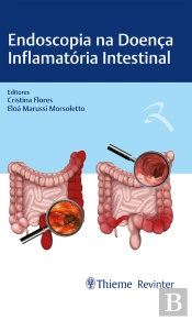 Endoscopia Na Doença Inflamatória Intestinal