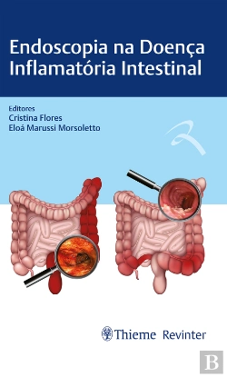 Bertrand.pt - Endoscopia Na Doença Inflamatória Intestinal