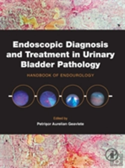 Bertrand.pt - Endoscopic Diagnosis And Treatment In Urinary Bladder Pathology