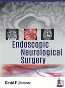 Bertrand.pt - Endoscopic Neurological Surgery