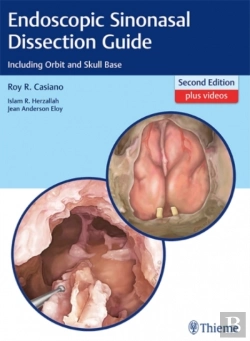 Bertrand.pt - Endoscopic Sinonasal Dissection Guide