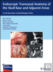 Endoscopic Transnasal Anatomy of the Skull Base and Adjacent Areas