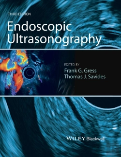 Bertrand.pt - Endoscopic Ultrasonography