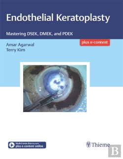 Bertrand.pt - Endothelial Keratoplasty