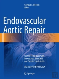 Bertrand.pt - Endovascular Aortic Repair