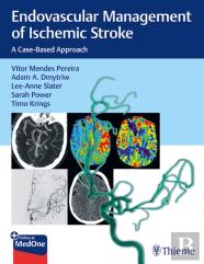 Endovascular Management Of Ischemic Stroke