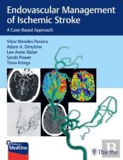 Endovascular Management Of Ischemic Stroke