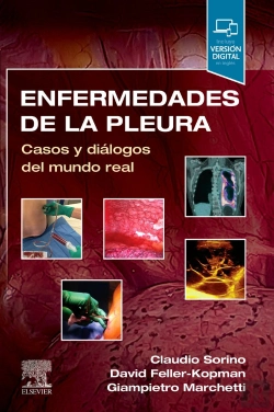 Bertrand.pt - Enfermedades De La Pleura