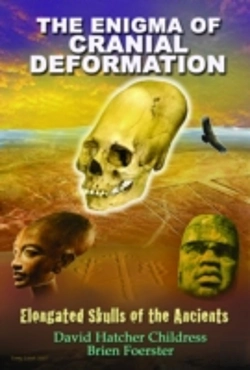 Bertrand.pt - Enigma Of Cranial Deformation