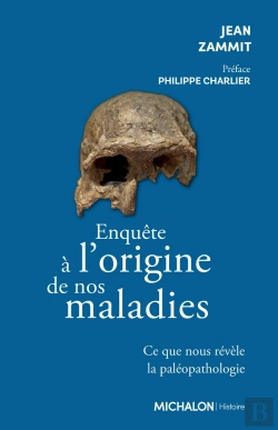 Bertrand.pt - Enquête À L'Origine De Nos Maladies : Ce Que Nous Révèle La Paléopathologie