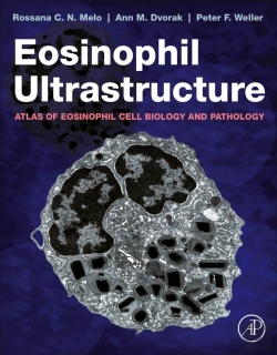 Bertrand.pt - Eosinophil Ultrastructure