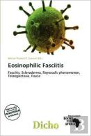 Eosinophilic Fasciitis