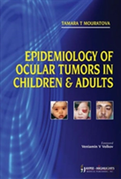 Bertrand.pt - Epidemiology Of Ocular Tumors In Children & Adults