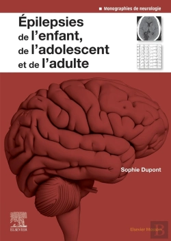 Bertrand.pt - Épilepsies De L'Enfant, De L'Adolescent Et De L'Adulte