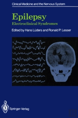 Bertrand.pt - Epilepsy