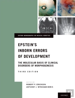Bertrand.pt - Epstein'S Inborn Errors Of Development